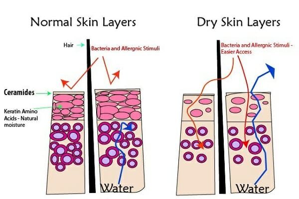ceramide cream có tốt không ceramide cream có tốt không
